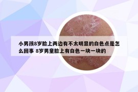 小男孩8歲臉上兩邊有不太明顯的白色點(diǎn)是怎么回事 8歲男童臉上有白色一塊一塊的