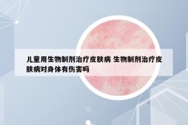 兒童用生物制劑治療皮膚病 生物制劑治療皮膚病對身體有傷害嗎