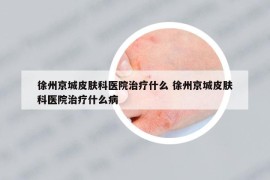 徐州京城皮膚科醫(yī)院治療什么 徐州京城皮膚科醫(yī)院治療什么病
