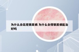 為什么會(huì)出現(xiàn)銀屑病 為什么會(huì)得銀屑病能治好嗎