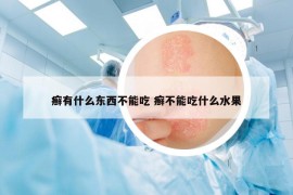 癬有什么東西不能吃 癬不能吃什么水果
