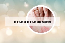 臉上長白斑 臉上長白斑是怎么回事