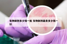 生物制劑多少錢(qián)一瓶 生物制劑最貴多少錢(qián)一針