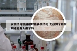 女孩子得銀屑病時能要孩子嗎 女孩得了銀屑病還能有人要了嗎
