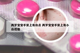 兩歲寶寶手背上有白點 兩歲寶寶手背上有小白疙瘩