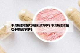 牛皮癬患者能吃硫酸亞鐵片嗎 牛皮癬患者能吃牛磺酸藥物嗎