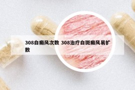 308白癜風(fēng)次數(shù) 308治療白斑癜風(fēng)易擴(kuò)散