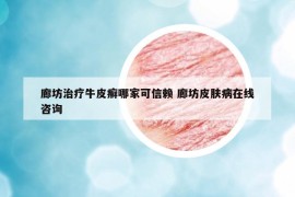 廊坊治療牛皮癬哪家可信賴(lài) 廊坊皮膚病在線(xiàn)咨詢(xún)