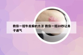 教你一招牛皮癬的方法 教你一招20秒讓鼻子通氣