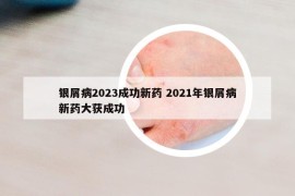 銀屑病2023成功新藥 2021年銀屑病新藥大獲成功