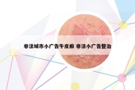 非法城市小廣告牛皮癬 非法小廣告整治
