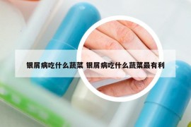 銀屑病吃什么蔬菜 銀屑病吃什么蔬菜最有利