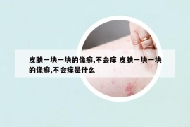 皮膚一塊一塊的像癬,不會癢 皮膚一塊一塊的像癬,不會癢是什么