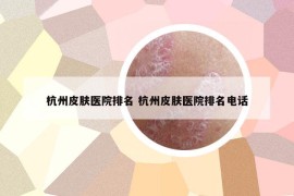 杭州皮膚醫(yī)院排名 杭州皮膚醫(yī)院排名電話