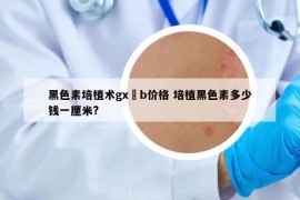 黑色素培植術gx–b價格 培植黑色素多少錢一厘米?