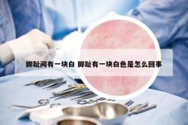 腳趾間有一塊白 腳趾有一塊白色是怎么回事