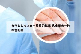 為什么頭皮上有一片片的紅蘚 頭皮里有一片紅色的癬