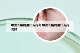 眼皮長癬的用什么藥膏 眼皮長癬的用什么藥膏好