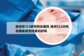 揚州市723研究所白癜風(fēng) 揚州723診所白顛瘋研究所真的好嗎