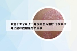 女童十歲了身上一身皮癬怎么治療 十歲女孩身上起紅疙瘩是怎么回事