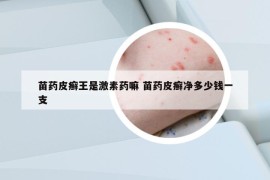 苗藥皮癬王是激素藥嘛 苗藥皮癬凈多少錢一支