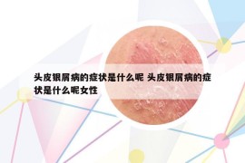 頭皮銀屑病的癥狀是什么呢 頭皮銀屑病的癥狀是什么呢女性