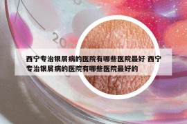 西寧專治銀屑病的醫(yī)院有哪些醫(yī)院最好 西寧專治銀屑病的醫(yī)院有哪些醫(yī)院最好的
