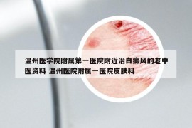 溫州醫(yī)學(xué)院附屬第一醫(yī)院附近治白癜風(fēng)的老中醫(yī)資料 溫州醫(yī)院附屬一醫(yī)院皮膚科