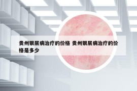 貴州銀屑病治療的價(jià)格 貴州銀屑病治療的價(jià)格是多少