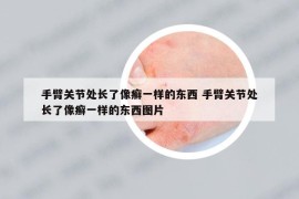 手臂關(guān)節(jié)處長了像癬一樣的東西 手臂關(guān)節(jié)處長了像癬一樣的東西圖片