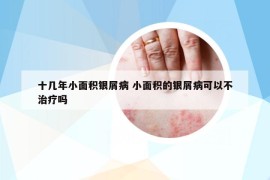 十幾年小面積銀屑病 小面積的銀屑病可以不治療嗎