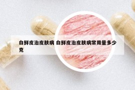 白鮮皮治皮膚病 白鮮皮治皮膚病常用量多少克