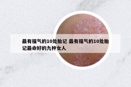 最有福氣的10處胎記 最有福氣的10處胎記最命好的九種女人