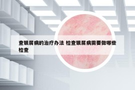查銀屑病的治療辦法 檢查銀屑病需要做哪些檢查