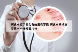 阿達(dá)木打了多久有效果克羅恩 阿達(dá)木單抗克羅恩一個療程要幾針