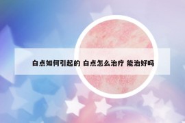 白點如何引起的 白點怎么治療 能治好嗎