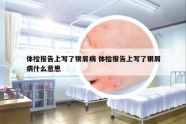 體檢報(bào)告上寫(xiě)了銀屑病 體檢報(bào)告上寫(xiě)了銀屑病什么意思