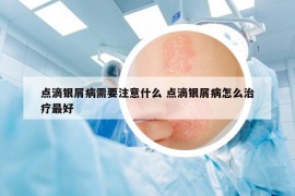 點(diǎn)滴銀屑病需要注意什么 點(diǎn)滴銀屑病怎么治療最好