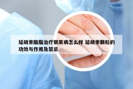 延胡索酸脂治療銀屑病怎么樣 延胡索顆粒的功效與作用及禁忌