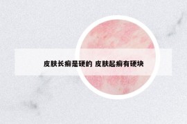 皮膚長癬是硬的 皮膚起癬有硬塊