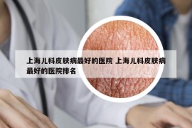 上海兒科皮膚病最好的醫(yī)院 上海兒科皮膚病最好的醫(yī)院排名