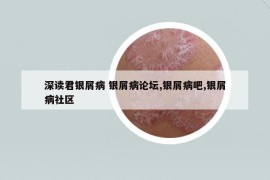 深讀君銀屑病 銀屑病論壇,銀屑病吧,銀屑病社區(qū)