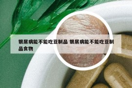 銀屑病能不能吃豆制品 銀屑病能不能吃豆制品食物