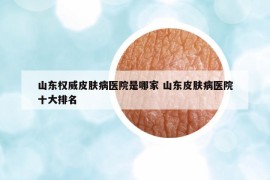 山東權(quán)威皮膚病醫(yī)院是哪家 山東皮膚病醫(yī)院十大排名