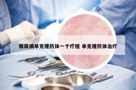 銀屑病單克隆抗體一個療程 單克隆抗體治療