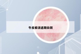牛皮癬消退期白斑