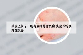 頭皮上長了一坨有點癢是什么癬 頭皮長坨很癢怎么辦