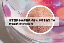 哪家醫(yī)院牛皮癬看的好廊坊 廊坊市有治療皮膚病的醫(yī)院嗎的短視頻
