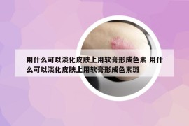 用什么可以淡化皮膚上用軟膏形成色素 用什么可以淡化皮膚上用軟膏形成色素斑