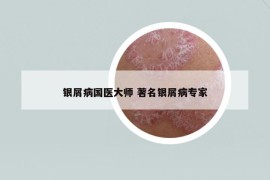 銀屑病國醫(yī)大師 著名銀屑病專家
